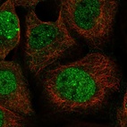 Immunofluorescent staining of human cell line A-431 shows localization to nucleoplasm & nuclear bodies.