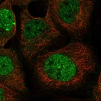 Immunofluorescent staining of human cell line A-431 shows localization to nucleoplasm & nuclear bodies.