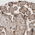 Immunohistochemical staining of human placenta shows moderate cytoplasmic positivity in trophoblastic cells.
