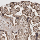 Immunohistochemical staining of human placenta shows moderate cytoplasmic positivity in trophoblastic cells.