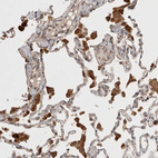 Immunohistochemical staining of human lung shows strong cytoplasmic positivity in macrophages.