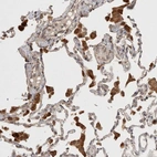 Immunohistochemical staining of human lung shows strong cytoplasmic positivity in macrophages.