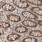 Immunohistochemical staining of human rectum shows moderate cytoplasmic positivity in glandular cells.