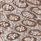 Immunohistochemical staining of human rectum shows moderate cytoplasmic positivity in glandular cells.
