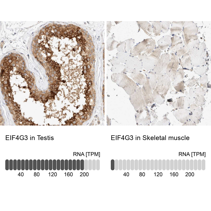 Anti-EIF4G3 Antibody