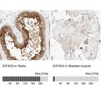 Anti-EIF4G3 Antibody