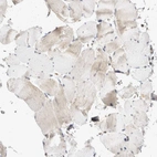 Immunohistochemical staining of human skeletal muscle shows low expression as expected.