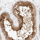 Immunohistochemical staining of human testis shows high expression.