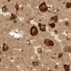 Immunohistochemical staining of human cerebral cortex using Anti-EIF4G3 antibody HPA025039.