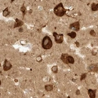 Immunohistochemical staining of human cerebral cortex using Anti-EIF4G3 antibody HPA025039.