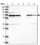 Lane 1: Marker [kDa] 230, 130, 95, 72, 56, 36, 28, 17, 11_br/_Lane 2: Human cell line RT-4_br/_Lane 3: Human cell line U-251MG sp_br/_Lane 4: Human plasma (IgG/HSA depleted)_br/_Lane 5: Human liver tissue_br/_Lane 6: Human tonsil tissue