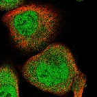 Immunofluorescent staining of human cell line A-431 shows localization to nucleoplasm & cytosol.