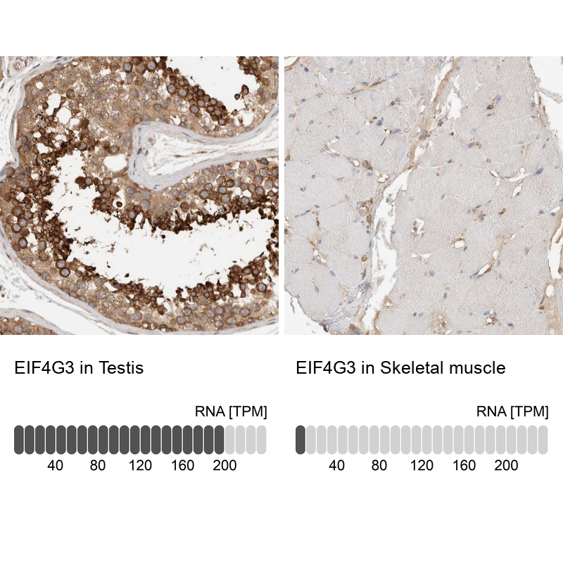 Anti-EIF4G3 Antibody
