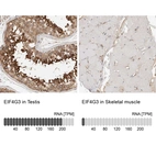 Anti-EIF4G3 Antibody