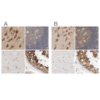 Immunohistochemical staining of human cerebral cortex, lymph node, skeletal muscle and testis using Anti-EIF4G3 antibody HPA025041 (A) shows similar protein distribution across tissues to independent antibody HPA025031 (B).