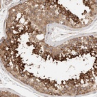 Immunohistochemical staining of human testis shows high expression.