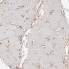 Immunohistochemical staining of human skeletal muscle shows low expression as expected.