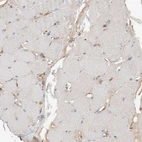 Immunohistochemical staining of human skeletal muscle shows low expression as expected.