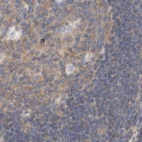 Immunohistochemical staining of human lymph node using Anti-EIF4G3 antibody HPA025041.
