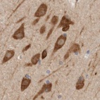 Immunohistochemical staining of human cerebral cortex using Anti-EIF4G3 antibody HPA025041.