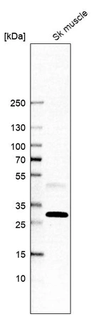 Western blot analysis in human skeletal muscle tissue.