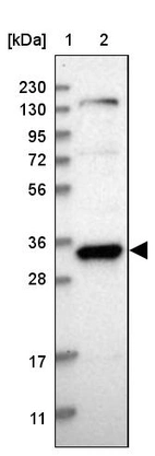 Lane 1: Marker [kDa] 230, 130, 95, 72, 56, 36, 28, 17, 11_br/_Lane 2: Human cell line RT-4