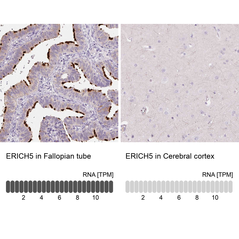 Anti-ERICH5 Antibody