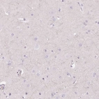 Immunohistochemical staining of human cerebral cortex shows low expression as expected.