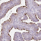 Anti-ERICH5 Antibody