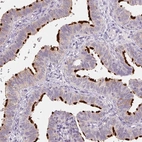Immunohistochemical staining of human fallopian tube shows high expression.