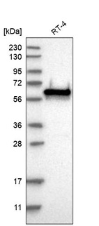 Western blot analysis in human cell line RT-4.