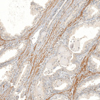 Anti-FBXO42 Antibody