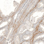 Anti-FBXO42 Antibody
