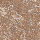 Immunohistochemical staining of human lymph node shows strong cytoplasmic positivity in non-germinal center cells.