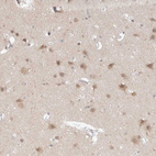 Immunohistochemical staining of human cerebral cortex shows moderate cytoplasmic positivity in neuronal cells.