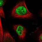 Immunofluorescent staining of human cell line U-251 MG shows localization to nucleoplasm.