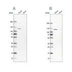 Western blot analysis using Anti-LEMD3 antibody HPA025078 (A) shows similar pattern to independent antibody HPA076986 (B).