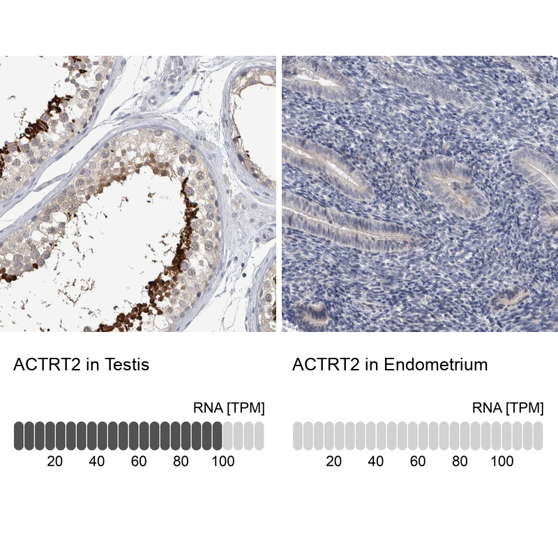 Anti-ACTRT2 Antibody