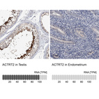 Anti-ACTRT2 Antibody
