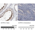 Anti-ACTRT2 Antibody