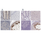 Immunohistochemical staining of human colon, liver, lymph node and testis using Anti-ACTRT2 antibody HPA025079 (A) shows similar protein distribution across tissues to independent antibody HPA006480 (B).