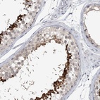 Immunohistochemical staining of human testis shows high expression.