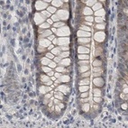 Immunohistochemical staining of human colon using Anti-ACTRT2 antibody HPA025079.
