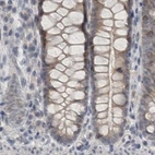 Immunohistochemical staining of human colon using Anti-ACTRT2 antibody HPA025079.