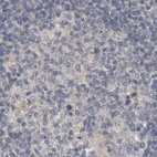 Immunohistochemical staining of human lymph node using Anti-ACTRT2 antibody HPA025079.