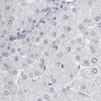 Immunohistochemical staining of human liver using Anti-ACTRT2 antibody HPA025079.