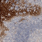 Immunohistochemical staining of human tonsil shows strong cytoplasmic positivity in squamous epithelial cells.