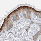 Immunohistochemical staining of human skin shows strong cytoplasmic positivity in squamous epithelial cells.