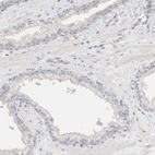 Immunohistochemical staining of human prostate shows no positivity in glandular cells as expected.