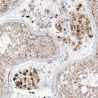 Immunohistochemical staining of human testis shows strong granular cytoplasmic positivity in Leydig cells.